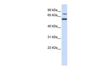 Anti-WDR51B antibody, N-term used in Western Blot (WB). GTX45242