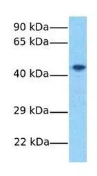 Anti-FAM175B antibody, Internal used in Western Blot (WB). GTX45284