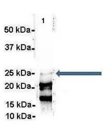 Anti-C1orf77 antibody, Internal used in Immunoprecipitation (IP). GTX45303