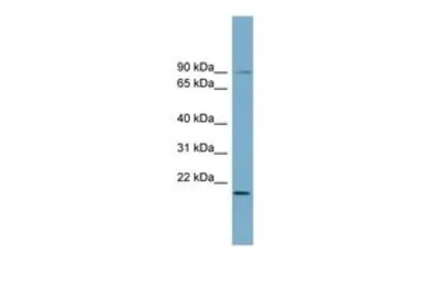 Anti-KIAA0776 antibody, Internal used in Western Blot (WB). GTX45316
