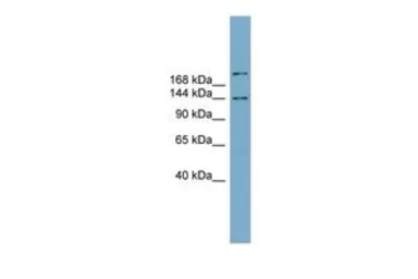 Anti-MAPKBP1 antibody, N-term used in Western Blot (WB). GTX45330