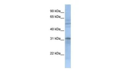 Anti-MTCH2 antibody, N-term used in Western Blot (WB). GTX45343