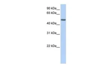 Anti-PHLDA1 antibody, C-term used in Western Blot (WB). GTX45377