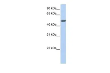 Anti-PHLDA1 antibody, Internal used in Western Blot (WB). GTX45378