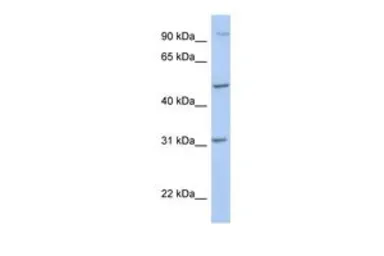Anti-PPM1J antibody, C-term used in Western Blot (WB). GTX45385