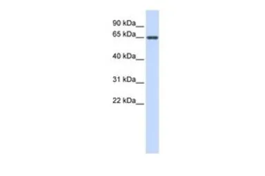 Anti-AMH antibody, Internal used in Western Blot (WB). GTX45442