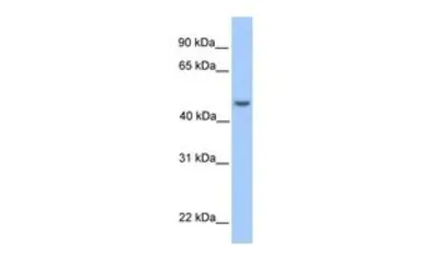 Anti-ASB6 antibody, Internal used in Western Blot (WB). GTX45549