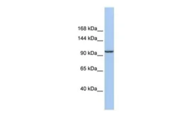 Anti-KLB antibody, Internal used in Western Blot (WB). GTX45558