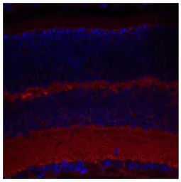 Anti-SYT9 antibody, Internal used in IHC (Paraffin sections) (IHC-P). GTX45560