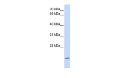 Anti-ZG16 antibody, Internal used in Western Blot (WB). GTX45673