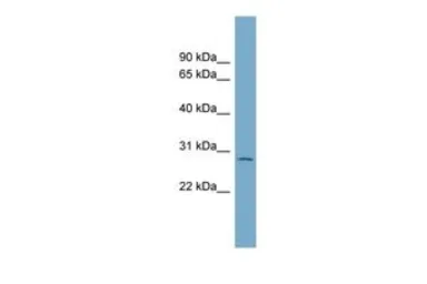 Anti-C1orf96 antibody, N-term used in Western Blot (WB). GTX45691
