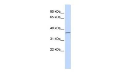 Anti-LRRC25 antibody, N-term used in Western Blot (WB). GTX45692