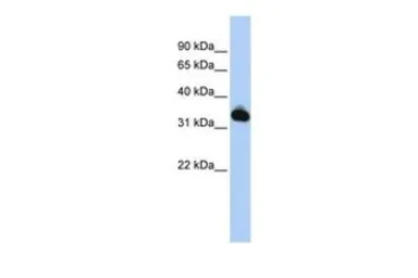 Anti-GALM antibody, N-term used in Western Blot (WB). GTX45731