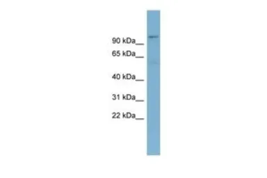Anti-TBL3 antibody, N-term used in Western Blot (WB). GTX45804