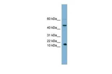 Anti-INSL5 antibody, Internal used in Western Blot (WB). GTX45807