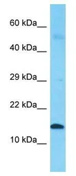 Anti-INSL5 antibody, Internal used in Western Blot (WB). GTX45807