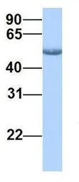 Anti-Casein Kinase 1 gamma 2 antibody, Internal used in Western Blot (WB). GTX45815