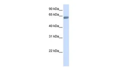 Anti-SLC47A2 antibody, C-term used in Western Blot (WB). GTX45823