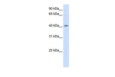 Anti-FAM54A antibody, Internal used in Western Blot (WB). GTX45824