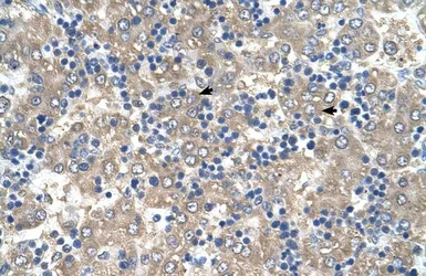 Anti-C3ORF10 antibody, Internal used in IHC (Paraffin sections) (IHC-P). GTX45866