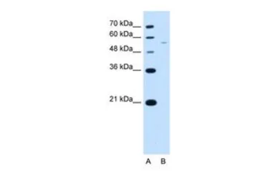 Anti-RSRC2 antibody, C-term used in Western Blot (WB). GTX45867