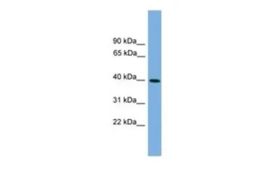 Anti-ITLN2 antibody, Internal used in Western Blot (WB). GTX45879
