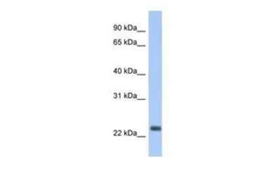 Anti-ND6 antibody, Internal used in Western Blot (WB). GTX45885