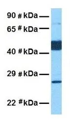 Anti-PIK3IP1 antibody, Internal used in Western Blot (WB). GTX45899