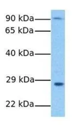 Anti-SURF4 antibody, N-term used in Western Blot (WB). GTX45909