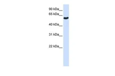 Anti-SYT3 antibody, N-term used in Western Blot (WB). GTX45928
