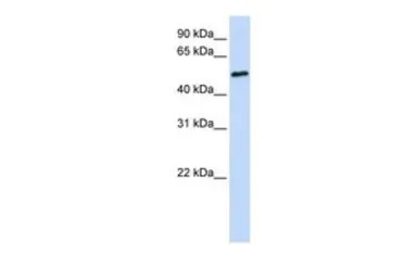 Anti-IRTA1 antibody, N-term used in Western Blot (WB). GTX45946