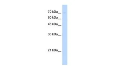 Anti-UNC93B1 antibody, N-term used in Western Blot (WB). GTX45950