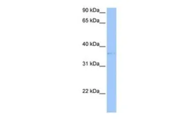 Anti-TREML2 antibody, Internal used in Western Blot (WB). GTX45970