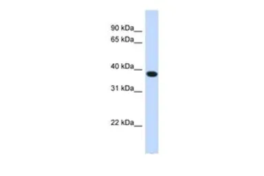 Anti-ACBD4 antibody, N-term used in Western Blot (WB). GTX45977