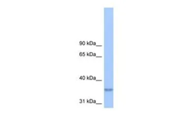 Anti-LPPR2 antibody, Internal used in Western Blot (WB). GTX46008