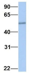 Anti-EDAR antibody, Internal used in Western Blot (WB). GTX46019