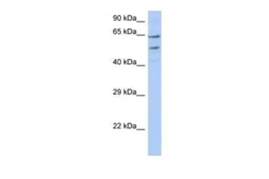 Anti-TMCC3 antibody, N-term used in Western Blot (WB). GTX46046