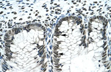 Anti-Gli2 antibody, Internal used in IHC (Paraffin sections) (IHC-P). GTX46056