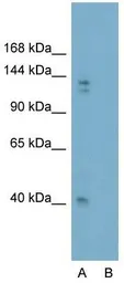 Anti-Gli2 antibody, Internal used in Western Blot (WB). GTX46056