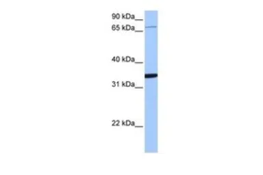 Anti-PCDHA10 antibody, N-term used in Western Blot (WB). GTX46082