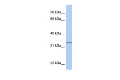 Anti-GSTO2 antibody, Internal used in Western Blot (WB). GTX46115