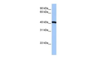 Anti-FTSJ1 antibody, N-term used in Western Blot (WB). GTX46119