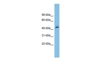 Anti-PNPLA1 antibody, Internal used in Western Blot (WB). GTX46129