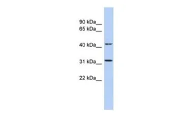 Anti-METTL6 antibody, N-term used in Western Blot (WB). GTX46138