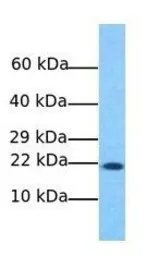Anti-NAT13 antibody, C-term used in Western Blot (WB). GTX46161