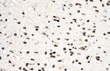 Anti-PGS1 antibody, C-term used in IHC (Paraffin sections) (IHC-P). GTX46171
