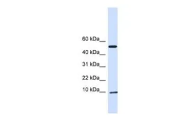 Anti-ATPIF1 antibody, N-term used in Western Blot (WB). GTX46233