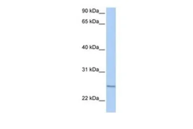 Anti-RABL4 antibody, C-term used in Western Blot (WB). GTX46248