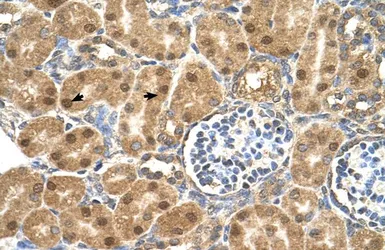 Anti-PTGDS antibody, N-term used in IHC (Paraffin sections) (IHC-P). GTX46255