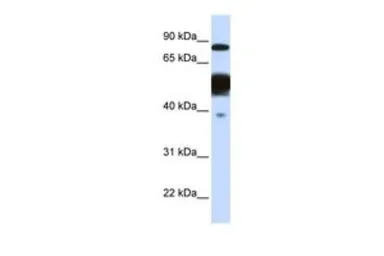 Anti-NEXN antibody, Internal used in Western Blot (WB). GTX46266